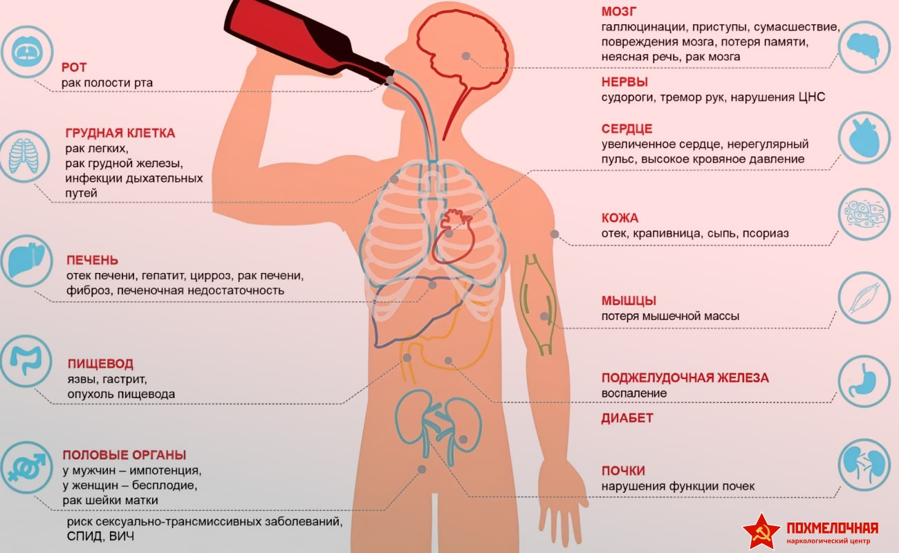 Инфографика проблемы алкоголизма