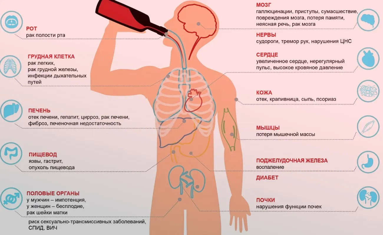 Инфографика проблемы алкоголизма